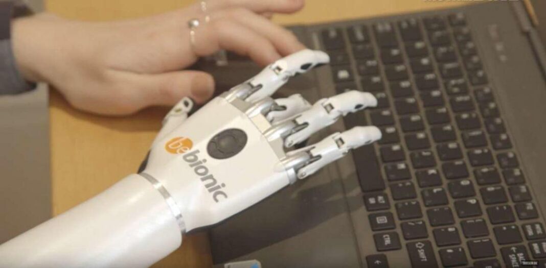 protesi robotiche